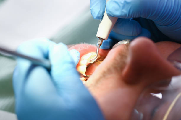 Best Emergency Treatment for Toothache in Franklin, NC