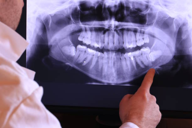 Best Emergency Dental Care for Trauma or Injury in Franklin, NC