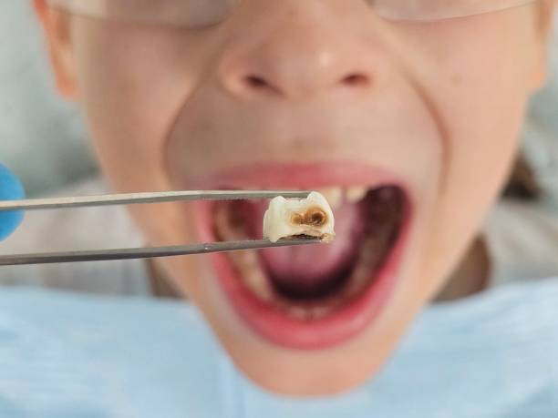 Best Walk-In Emergency Dentist in Franklin, NC